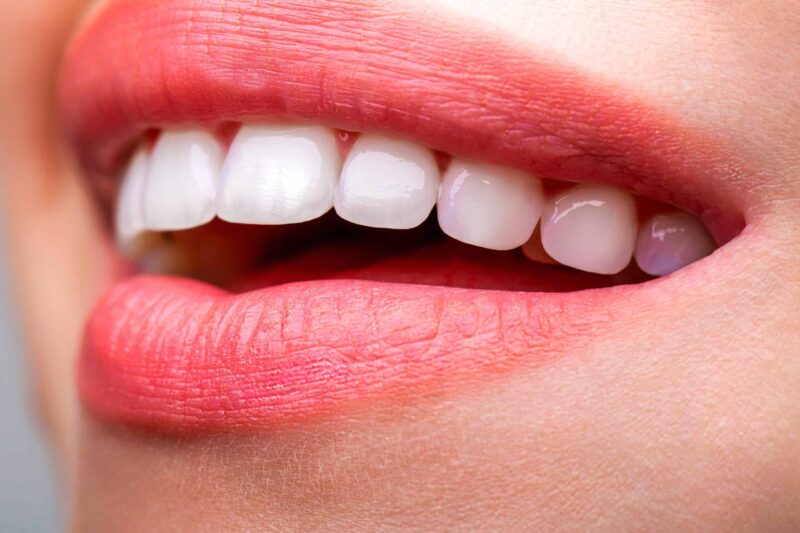 clinton teeth whitening